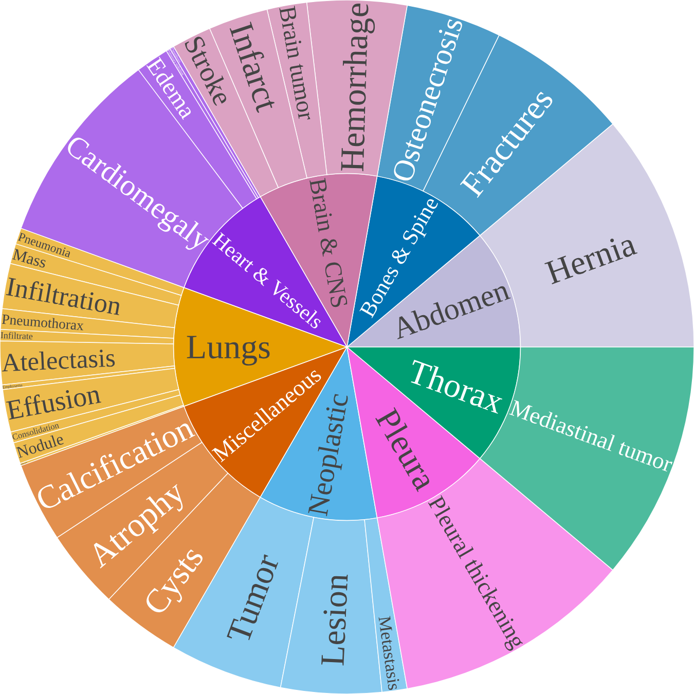 Organ-wise Data Distribution
